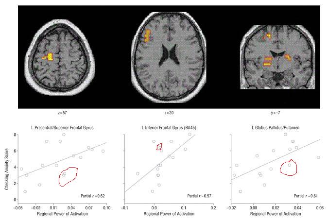 ocd fmri.jpg